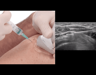 /Content/ServiceImages/USG-Guided (2).png